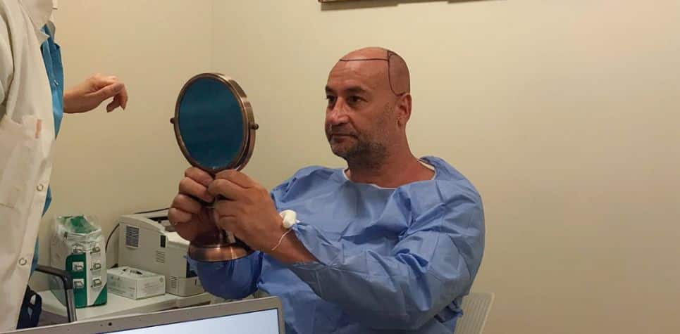 What is the Best Technology for Hair Transplantation?