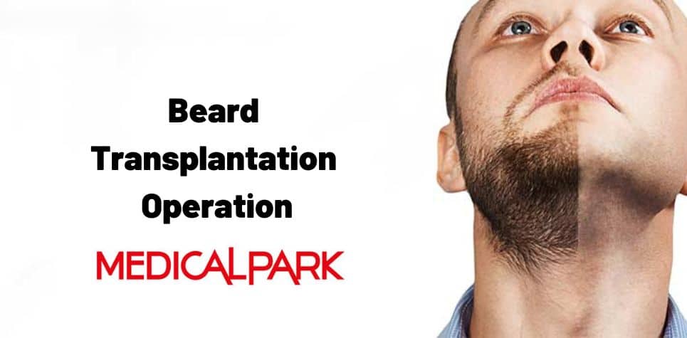 Things to Know About DHI Beard Transplantation